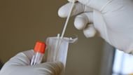 No DNA evidence to support the case (Image via Unsplash)